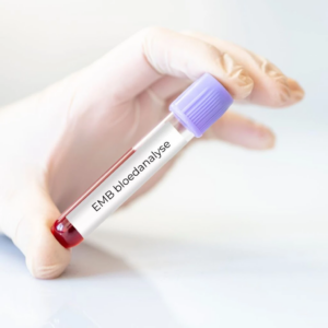 EMB Bloedtest
